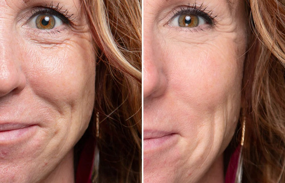 Anti aging szérum - 3% Bakuchiollal Ferm3™ technológiával - Retinol alternatva irritáció nélkül gyönyörű egészséges bőr.